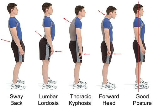 Good Posture: What It Looks Like & Its Benefits To You